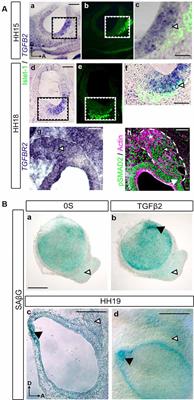 Otic Neurogenesis Is Regulated by TGFβ in a Senescence-Independent Manner